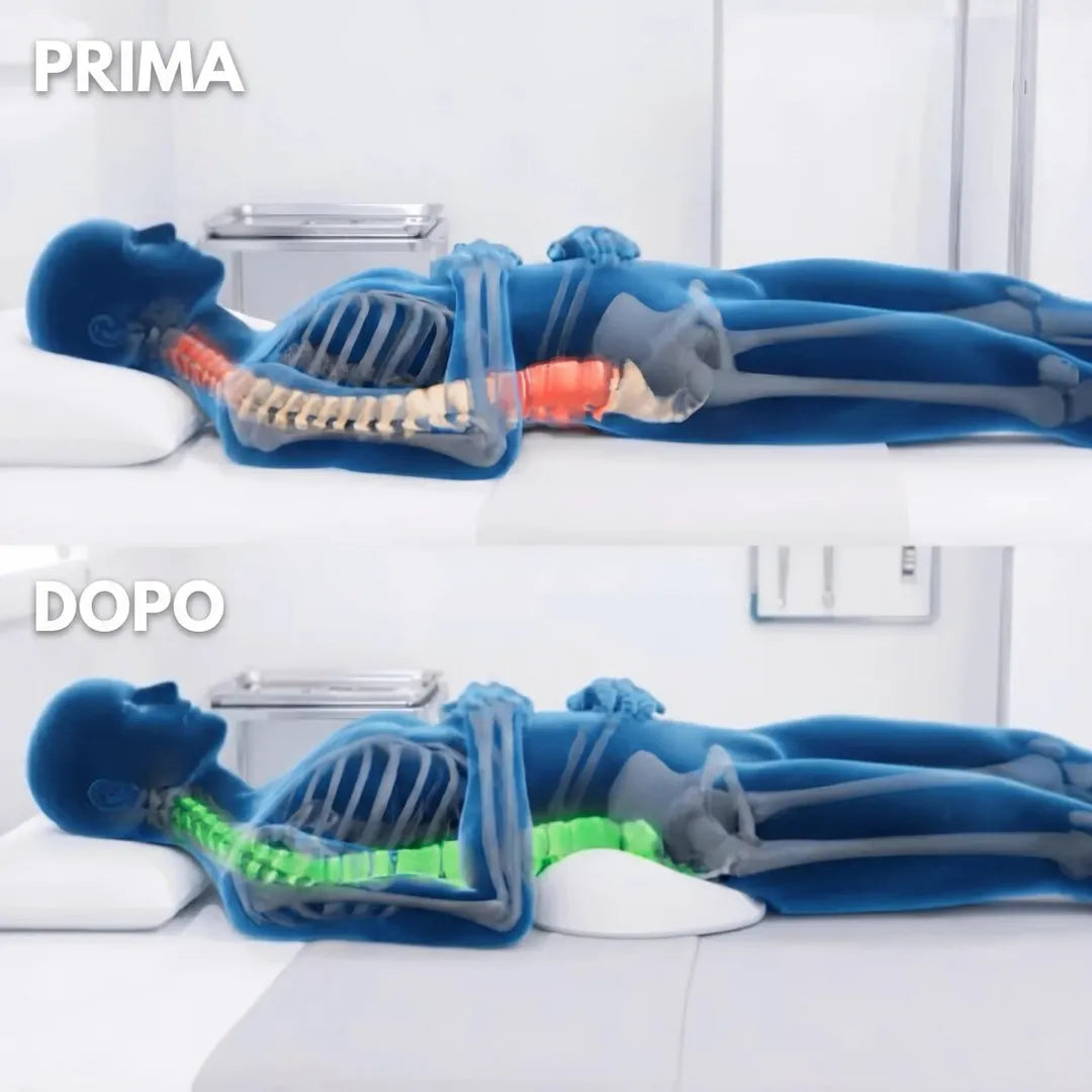Schiena prima e dopo