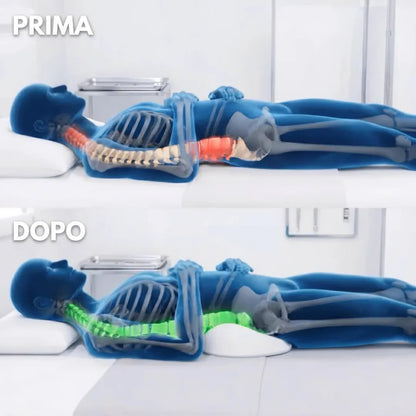 Schiena prima e dopo